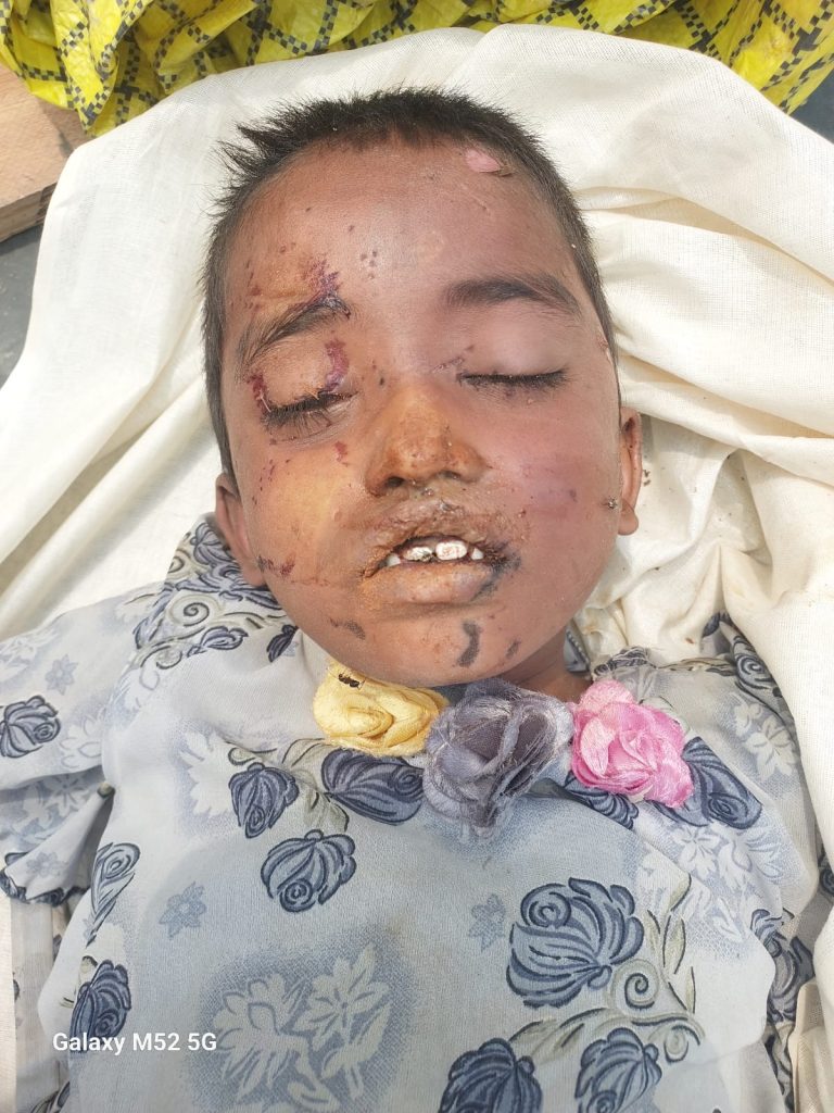 मिर्जापुर में सड़क किनारे झाड़ियों में मिली अज्ञात बालिका की लाश, पहचान के लिए पुलिस ने जारी की अपील