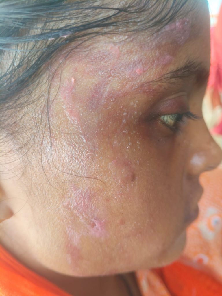 दहेज की मांग को लेकर महिला से मारपीट का आरोप, भाई ने पुलिस से की शिकायत